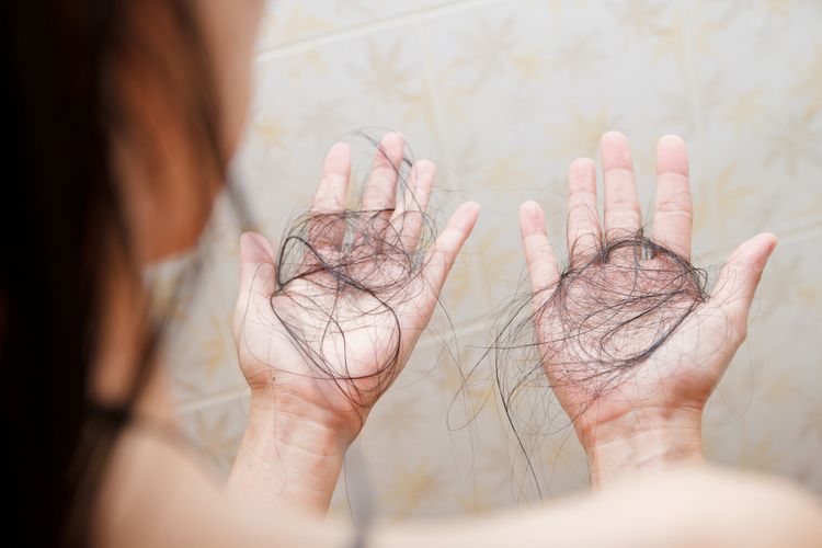 Penyebab Kerontokan Rambut : Ini Cara Mengatasinya